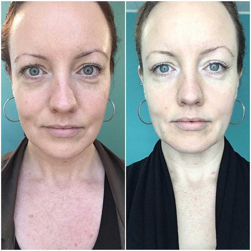 My Bend Beauty Review: Laura Richey, Esthetician