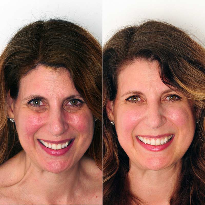 Real Results with Bend Beauty