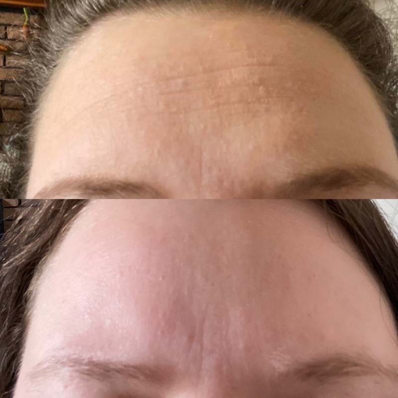 Real Results from Marine Collagen + Co-Factors