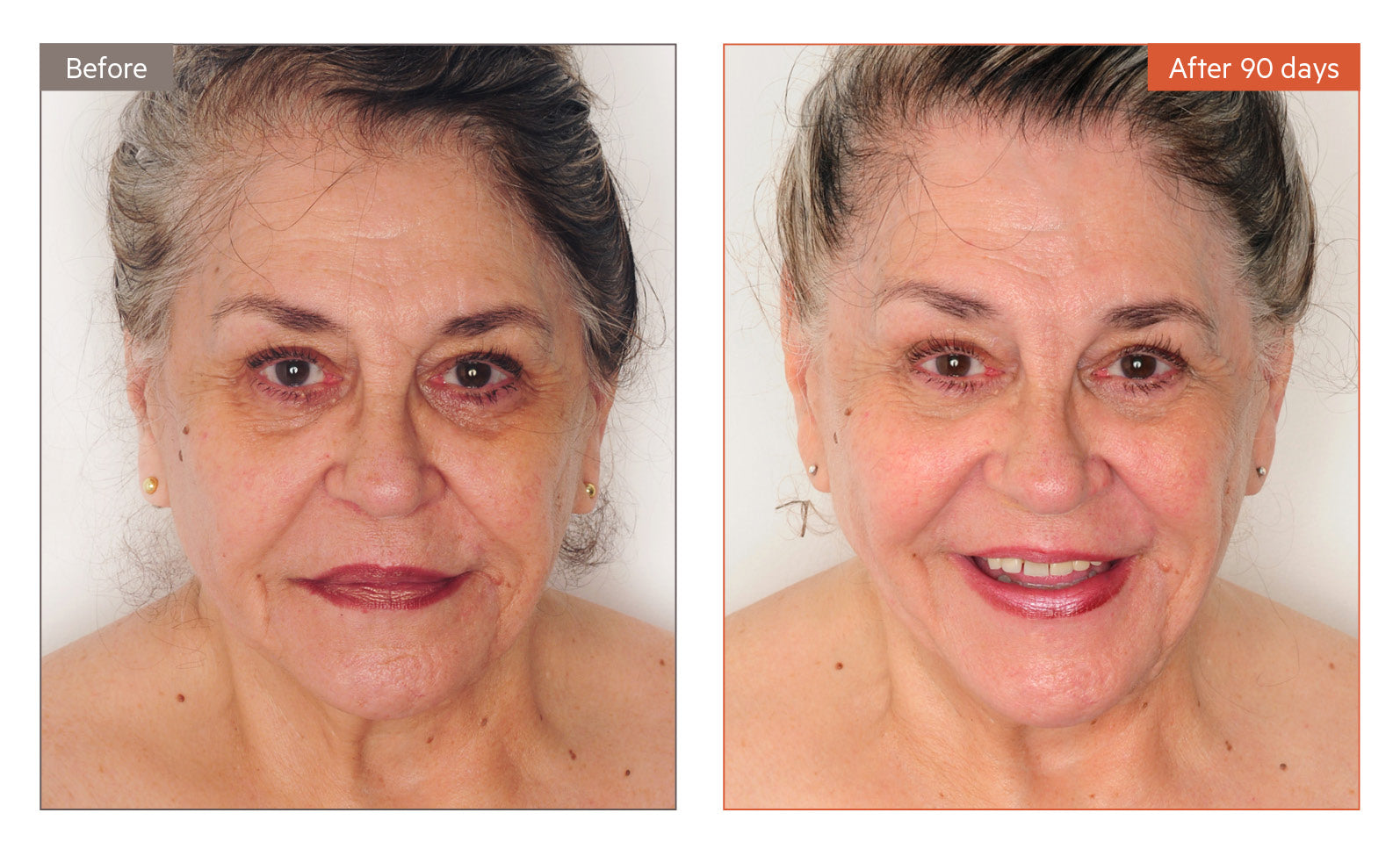 Beauty at Any Age